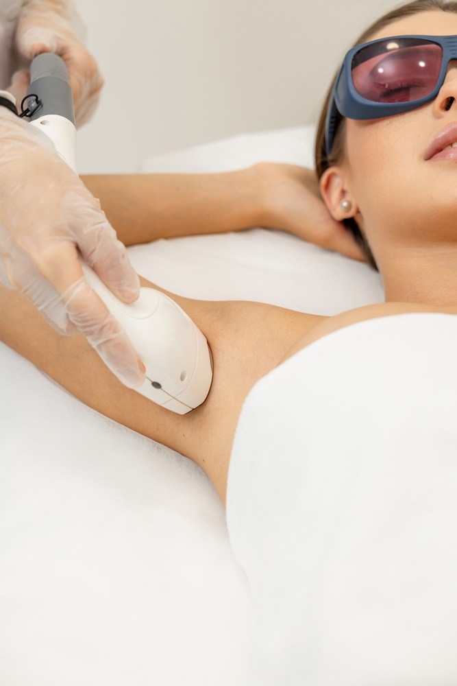 Epilazione laser donna